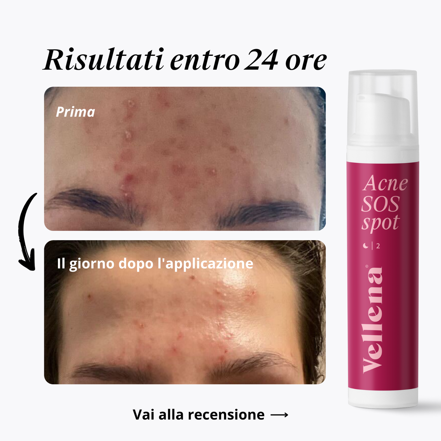 Acne SOS Spot 15ml | Vellena